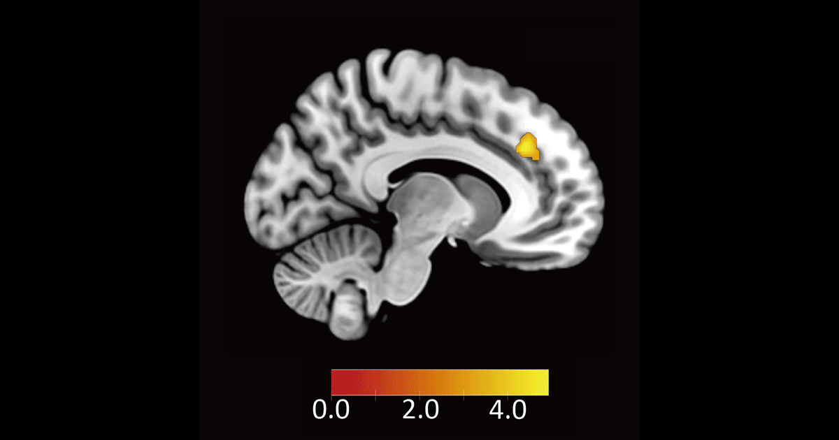 ヒトが不公平な提案を受け入れる時の脳内メカニズムを解明